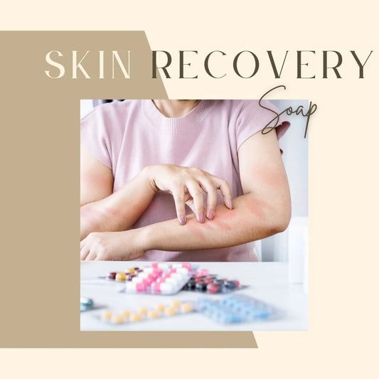 SOA Skin Recovery Soap (Itch soap for People)